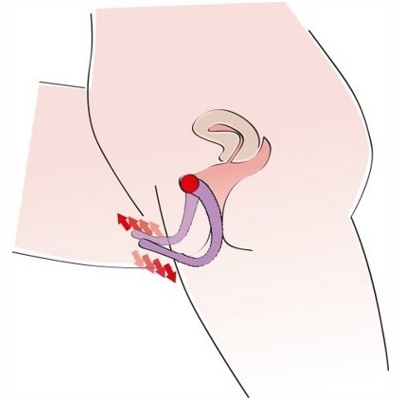 «Intimate Spreader» – Вагинальный расширитель- фото6