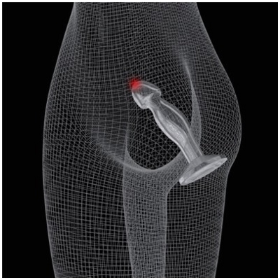 «Flawless Clear Prostate Plug 6.5''» - Анальная пробка- фото5